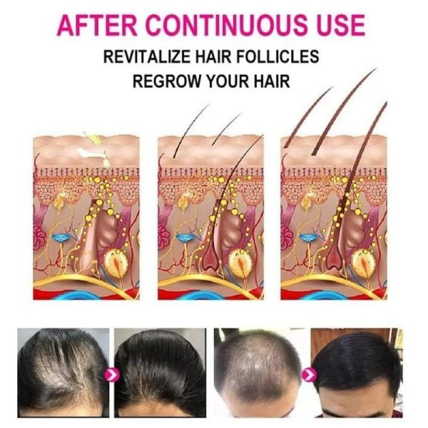 Anti-Grey Hair Serum 30ml – Restores Natural Hair Color and Boosts Shine
Product Type: Hair Care – Anti-Grey Hair Serum