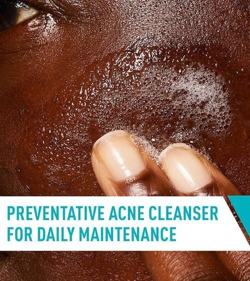 CeraVe Acne Control Cleanser, 237ml bottle, designed to reduce blackheads, clear acne, and hydrate skin