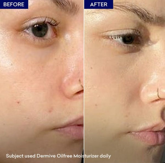 Dermive Oil-Free Moisturizer - Hydrating and Non-Greasy Skin Care Solution for All Skin Types