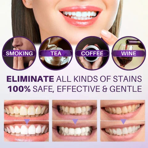 Hismiles V34 Colour Corrector Serum (30ml) for Teeth Brightening and Stain Removal