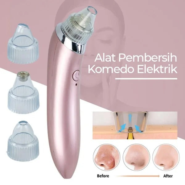 Professional Blackhead Removal Tool – Pore Vacuum for Nose & Face