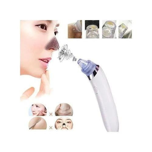 Professional Blackhead Removal Tool – Pore Vacuum for Nose & Face