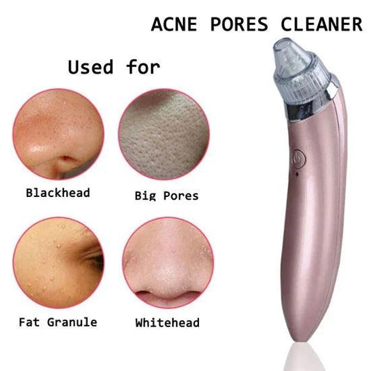 Professional Blackhead Removal Tool – Pore Vacuum for Nose & Face