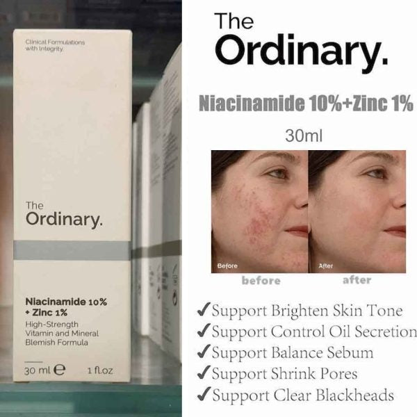 "The Ordinary Niacinamide 10% + Zinc 1% Serum, 30ml bottle, brightening and oil control formula for smoother skin."