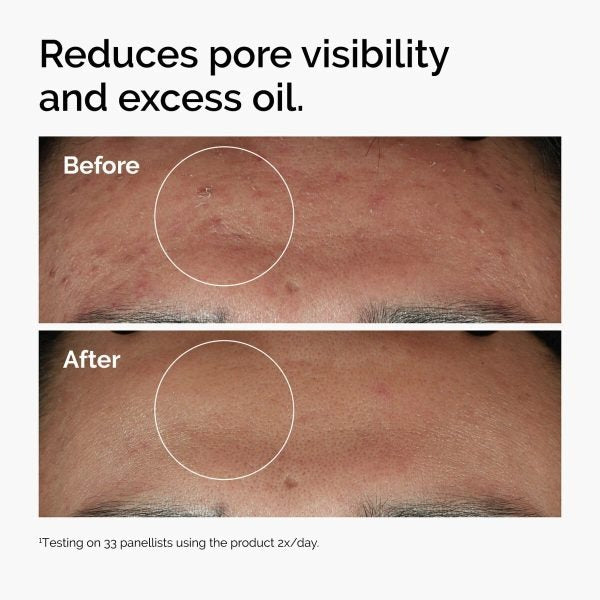 "The Ordinary Niacinamide 10% + Zinc 1% Serum, 30ml bottle, brightening and oil control formula for smoother skin."