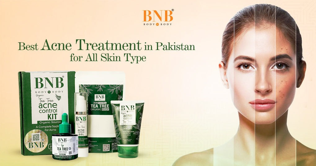 Best acne treatment products in Pakistan for clear skin