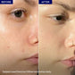 Dermive Oil-Free Moisturizer - Hydrating and Non-Greasy Skin Care Solution for All Skin Types