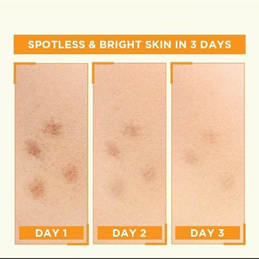 Garnier Bright Complete Vitamin C Booster Serum 30ml – Brightening & Radiant Skin Serum for Even Skin Tone

