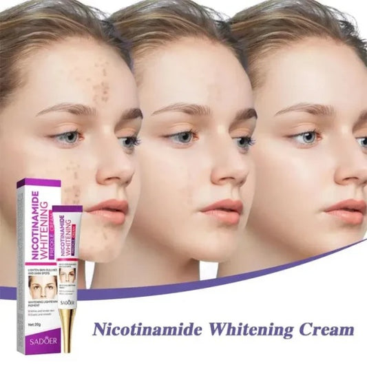Nicotinamide Whitening Freckles Cream – Melasma & Dark Spot Removal
