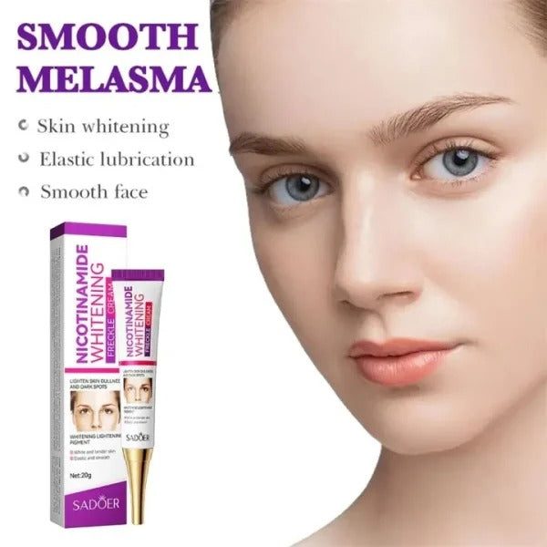 Nicotinamide Whitening Freckles Cream – Melasma & Dark Spot Removal
