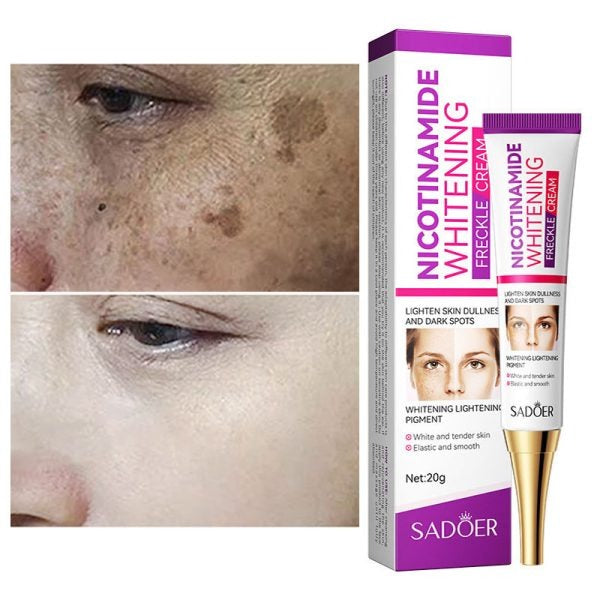 Nicotinamide Whitening Freckles Cream – Melasma & Dark Spot Removal
