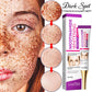 Nicotinamide Whitening Freckles Cream – Melasma & Dark Spot Removal
