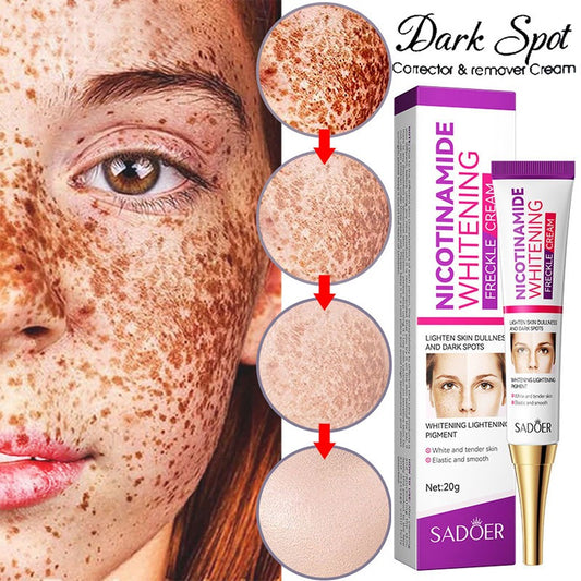 Nicotinamide Whitening Freckles Cream – Melasma & Dark Spot Removal
