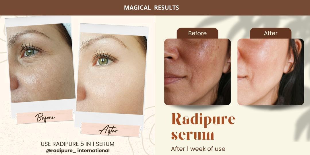 Radipure 5-in-1 Skin Whitening & Glowing Serum 30ml - Brightening, Hydrating & Nourishing Serum for Radiant Skin

